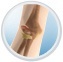 Elbow Fractue